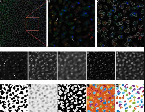 ML Guide on Cell Segmentation Using Watershed Algorithm
